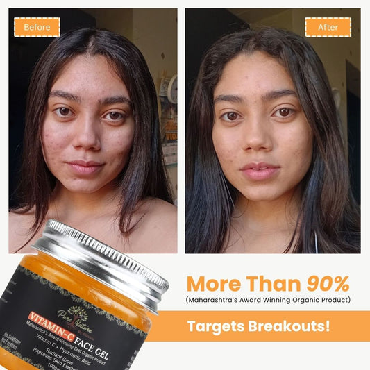 Pure Nature Vitamin-C Face Gel