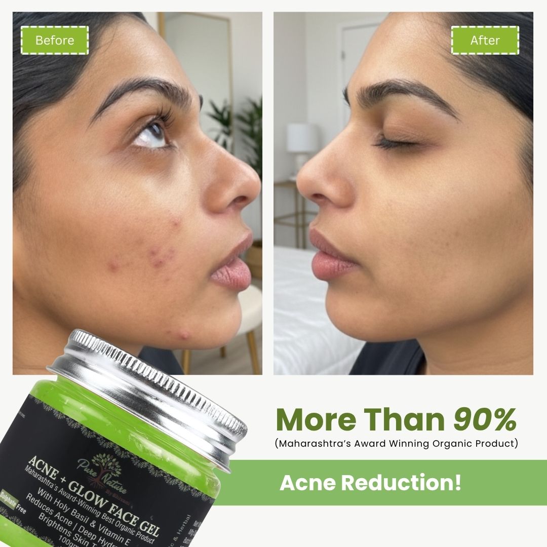Acne + Glow Face Gel