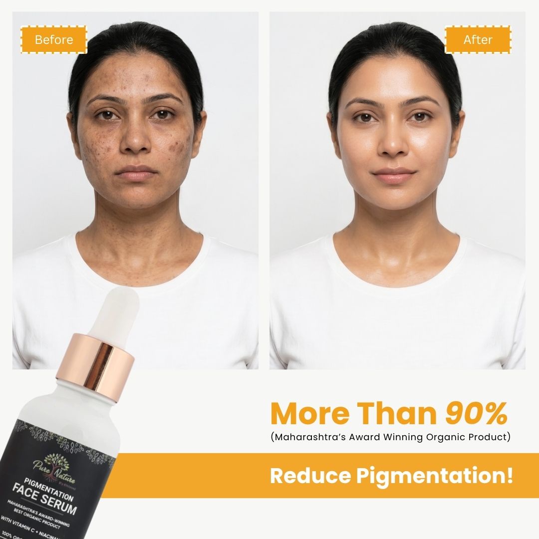 Pigmentation Face Serum