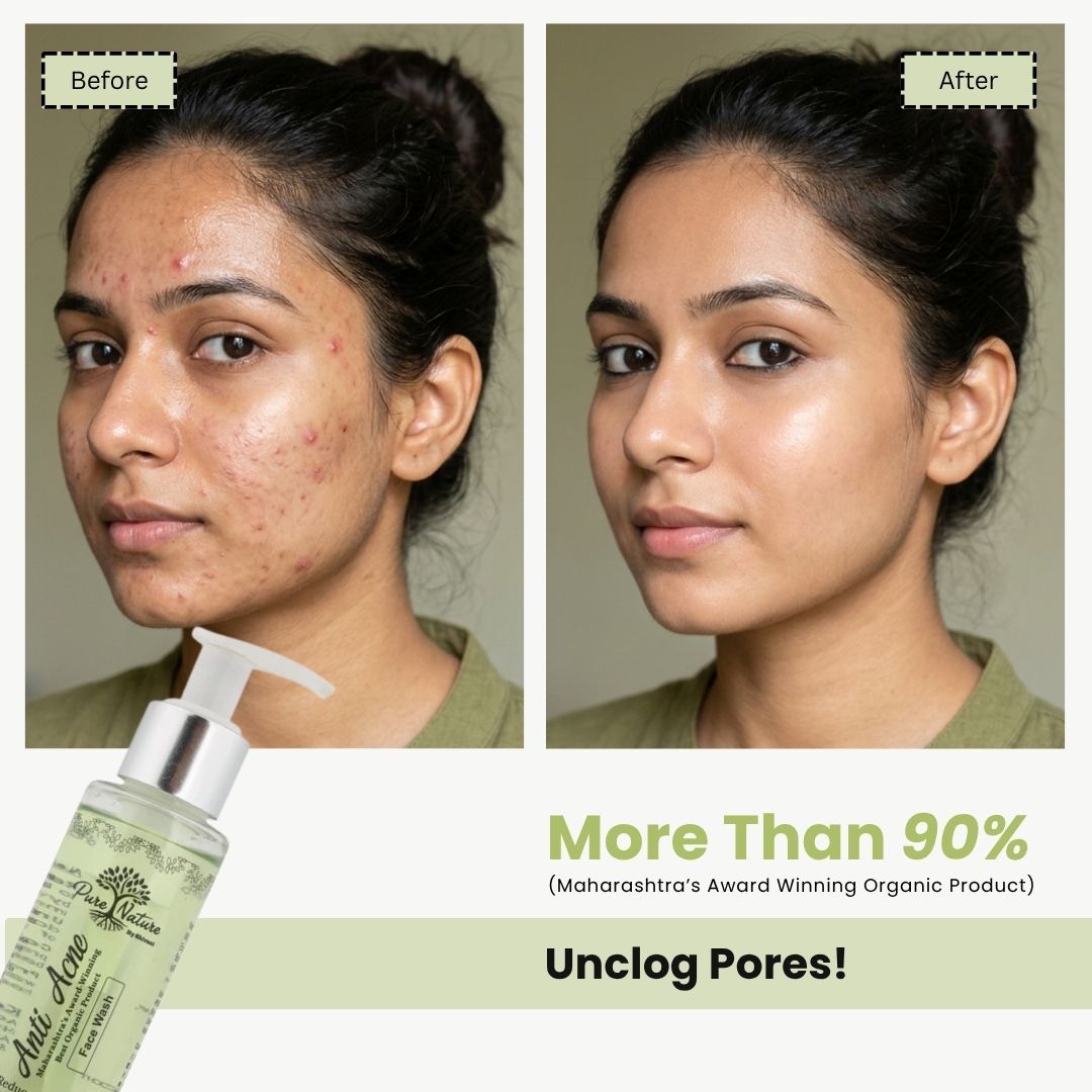 Anti Acne Face Wash