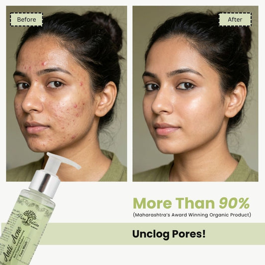 Pure Nature Anti Acne Face Wash